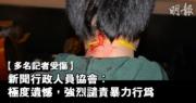 【旺角騷動】新聞行政人員協會遺憾記者採訪受辱受阻 譴責暴力 (14:19)