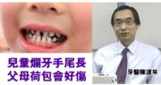 【猴年到】2歲女慘變老鼠牙花4萬救亡 牙醫:如嚴重要麻醉 埋單隨時過萬元 (16:23)