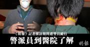 【旺角暴力衝突】《明報》記者遭警毆打 警派員到醫院了解 (13:36)