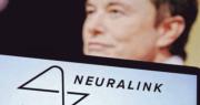 Neuralink：首位人腦晶片受試者植入設備出現問題