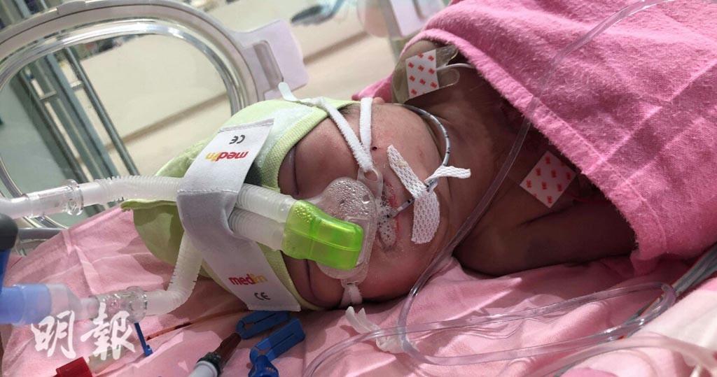 兒童醫院補心漏致心律不正　初生嬰需終身裝起搏器　母獲醫生建議去大灣區