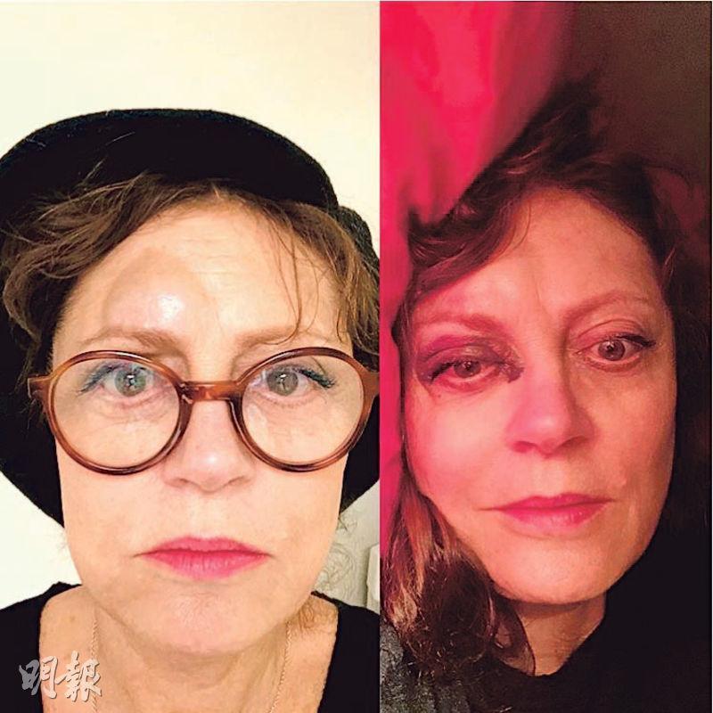 蘇珊莎朗頓跌倒腦震盪鼻骨折額腫眼黑 Showbiz 明報ol網