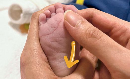 腳掌按摩：以拇指緊貼嬰兒腳前掌，慢慢穩定地推向腳跟。（圖片由作者提供）