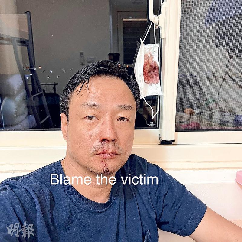 王喜被送到南投隔離才上載除了口罩的照片，並加上「Blame the victim」（怪責受害者）。（網上圖片）