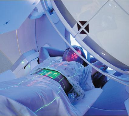 局部放射治療——中晚期肝癌治療的挑戰極大，使用局部放射治療能將腫瘤縮小，但腫瘤很快擴散至其他器官。（設計圖片，Mark Kostich@iStockphoto）