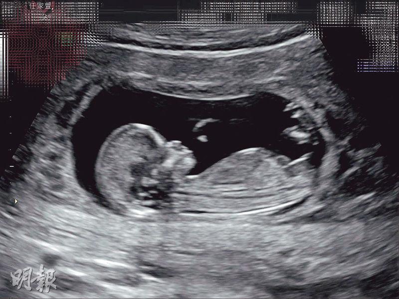 Selina昨日上載超聲波照宣布懷孕3個月。（網上圖片）