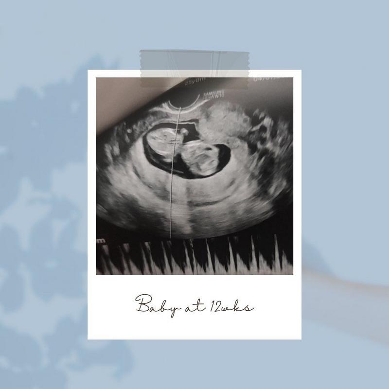 利愛安公開胎兒12周大的超聲波照片。（利愛安Ig圖片）
