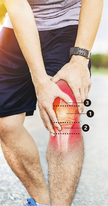 常見痛點——膝關節不同痛點反映不同問題。如痛點在髕骨正中（①），可能是髕股關節綜合徵；如痛點位於髕骨之下（②），可能是髕肌腱炎；痛點在髕骨之上（③），則可能是股四頭肌肌腱炎。（choochart choochaikupt@iStockphoto）