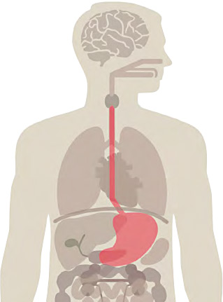 鄰近重要器官--食道鄰近有許多重要器官，如心臟、肺部、氣管、大動脈等，若腫瘤較大，病人可能出現吐血、呼吸困難等。（kowalska-art@iStockphoto）