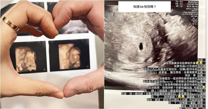 浩南分享懷孕初期的身體狀况。（鄭伊琪Ig圖片 / 明報製圖）
