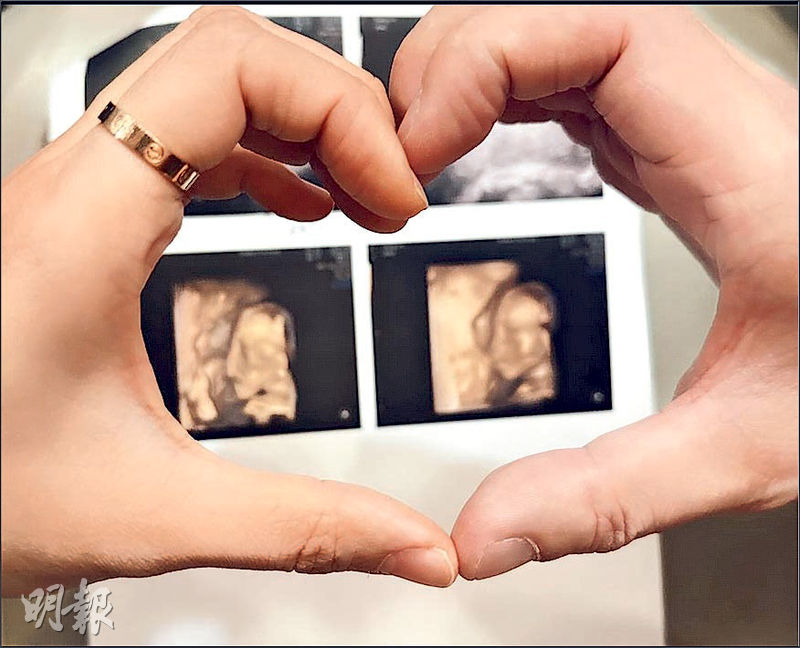 鄭伊琪懷孕20周，公開胎兒超聲波照片。（網上圖片）
