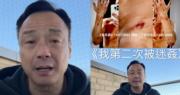 57歲王喜自揭兩度在台灣遭迷姦 親述事發經過兼公開傷勢