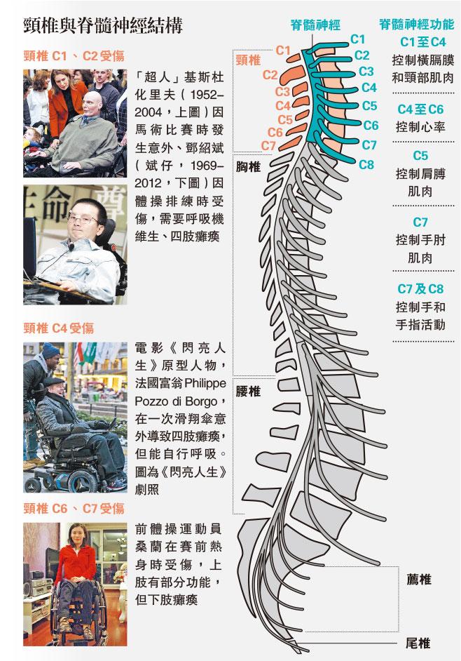 頸椎骨折移位 脊髓受損 了解機械腳復康治療