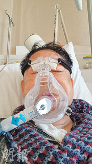 75歲黎彼得染流感肺花入ICU 戴氧氣罩插尿喉輸兩包血