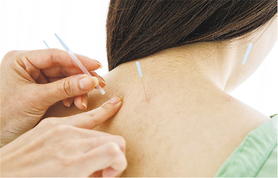 臨牀實證許多慢性痛症包括頸痛、肩膀痛、腰痛等,針灸治療卓有成效。(kokouu@iStockphoto)